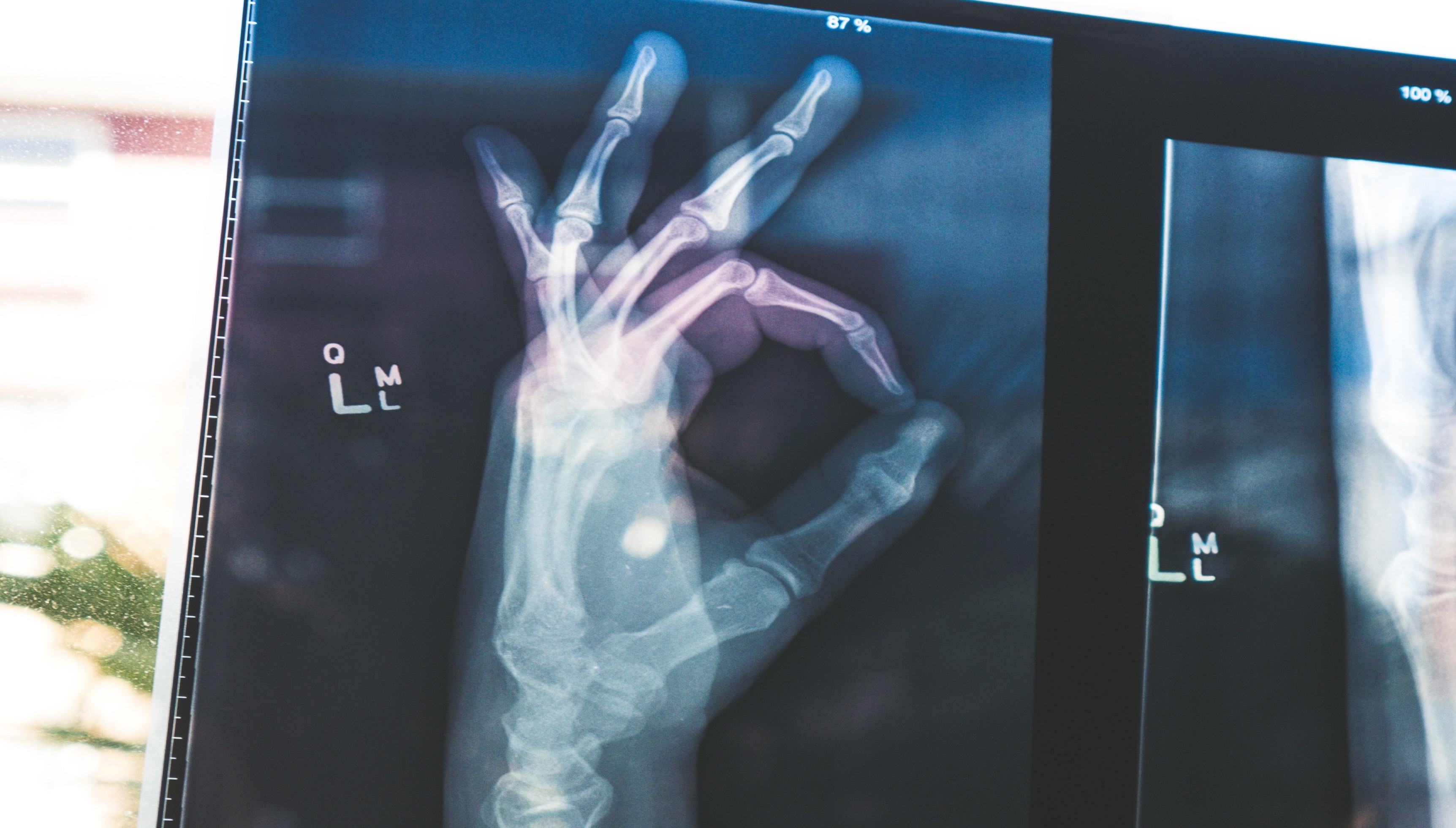 OK sign shot in a X-ray machine. (photo credit @owenbeard)